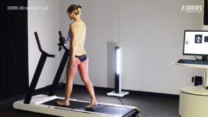3D optické vyšetrenie chrbtice DIERS Formetric 4D pri chôdzi na bežiacom páse bez röntgenového žiarenia